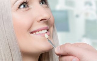 are veneers right for me