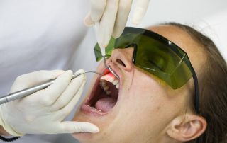 laser treatment rancho penesquitos