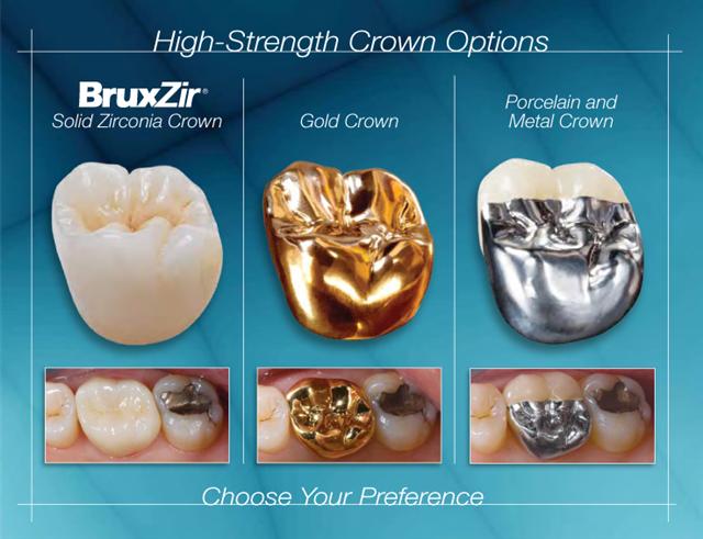 BruxZir® Solid Zirconia