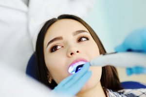 The Facts about fillings