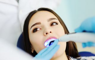 The Facts about fillings