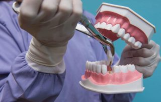 What You Should Know Before Getting a Tooth Extraction