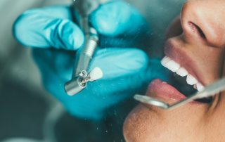 Cosmetic Dentist in North County