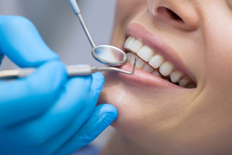 Teeth Scaling What You Need to Know Carmichael Dentistry Blog