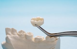 Why You Might Need a Dental Crown