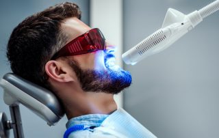 Dazzling Benefits of Teeth Whitening Beyond a Bright Smile
