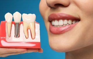 The Benefits of Dental Implants: Why They're a Superior Choice