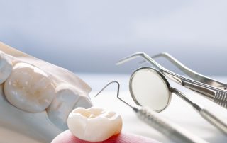 In What Scenarios Would Dental Crowns be Beneficial?