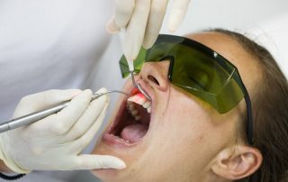 How Are Lasers Used to Treat Gum Disease?