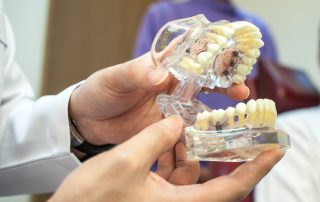 Why Full Mouth Reconstruction Is Life Changing for Severe Dental Damage and Function