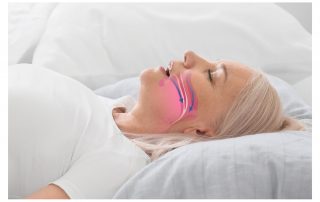 Improve Sleep Health with Sleep Apnea Solutions