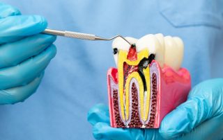 How to Know If a Toothache Needs a Root Canal or Emergency Dental Visit