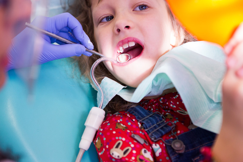 When Dental Sealants Are a Smart Choice for Cavity Prevention in Children and Teens