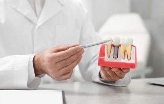How Dental Implants Help Restore Missing Teeth and Improve Your Smile