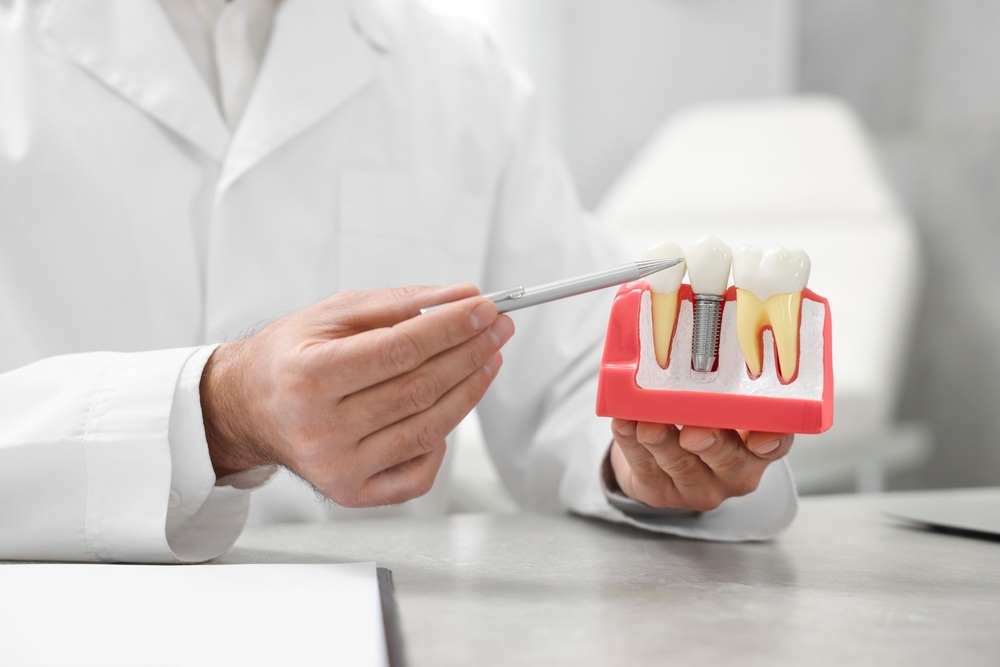 How Dental Implants Help Restore Missing Teeth and Improve Your Smile