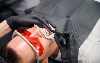When Professional Teeth Whitening Can Refresh Your Smile