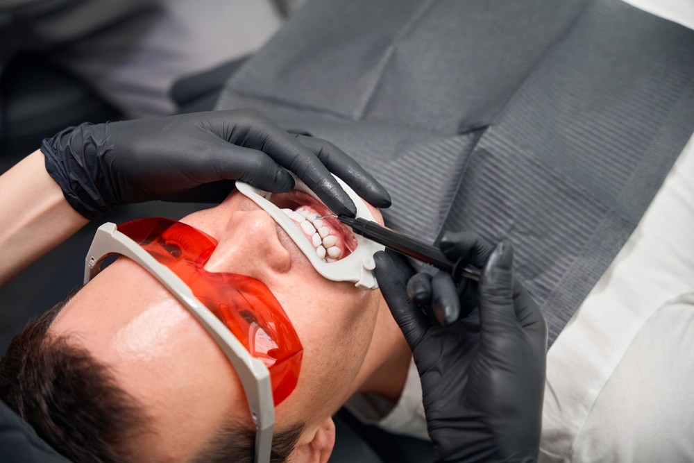 When Professional Teeth Whitening Can Refresh Your Smile